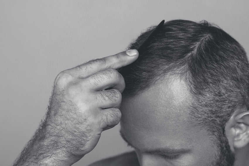 Sons’ Guide to Oral Minoxidil side effects