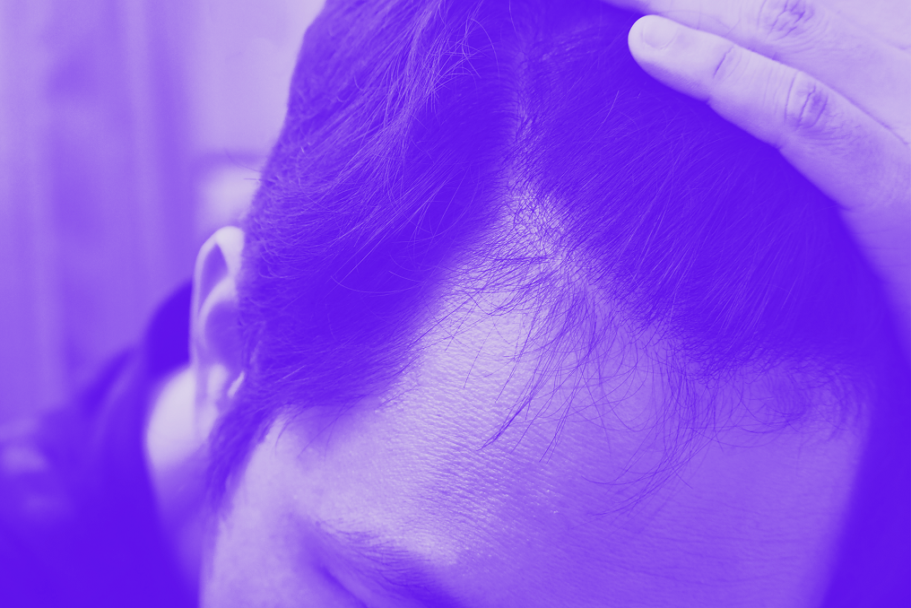 Optimising your hair loss treatment plan