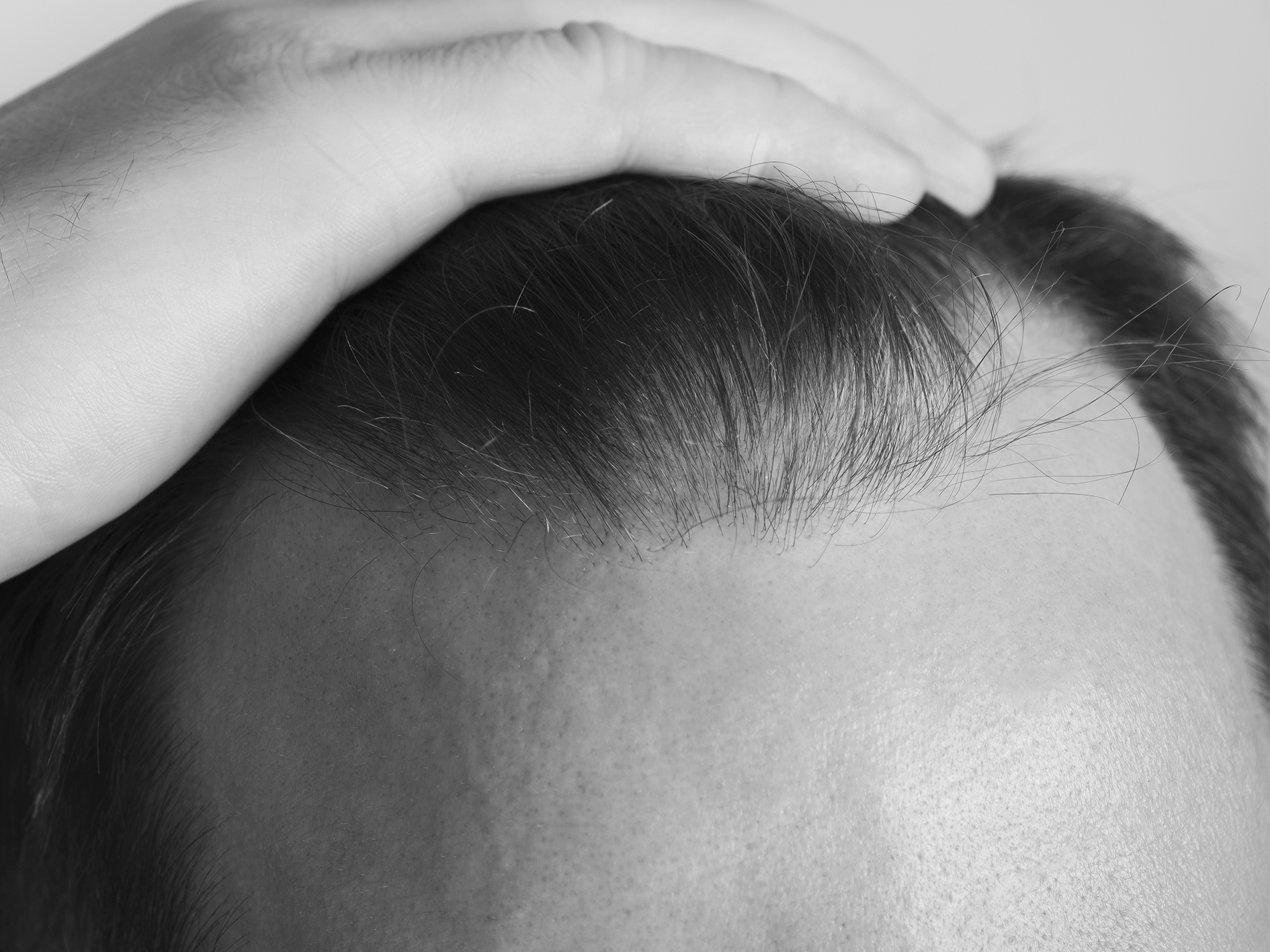 Answered: Can hair grow back after thinning?