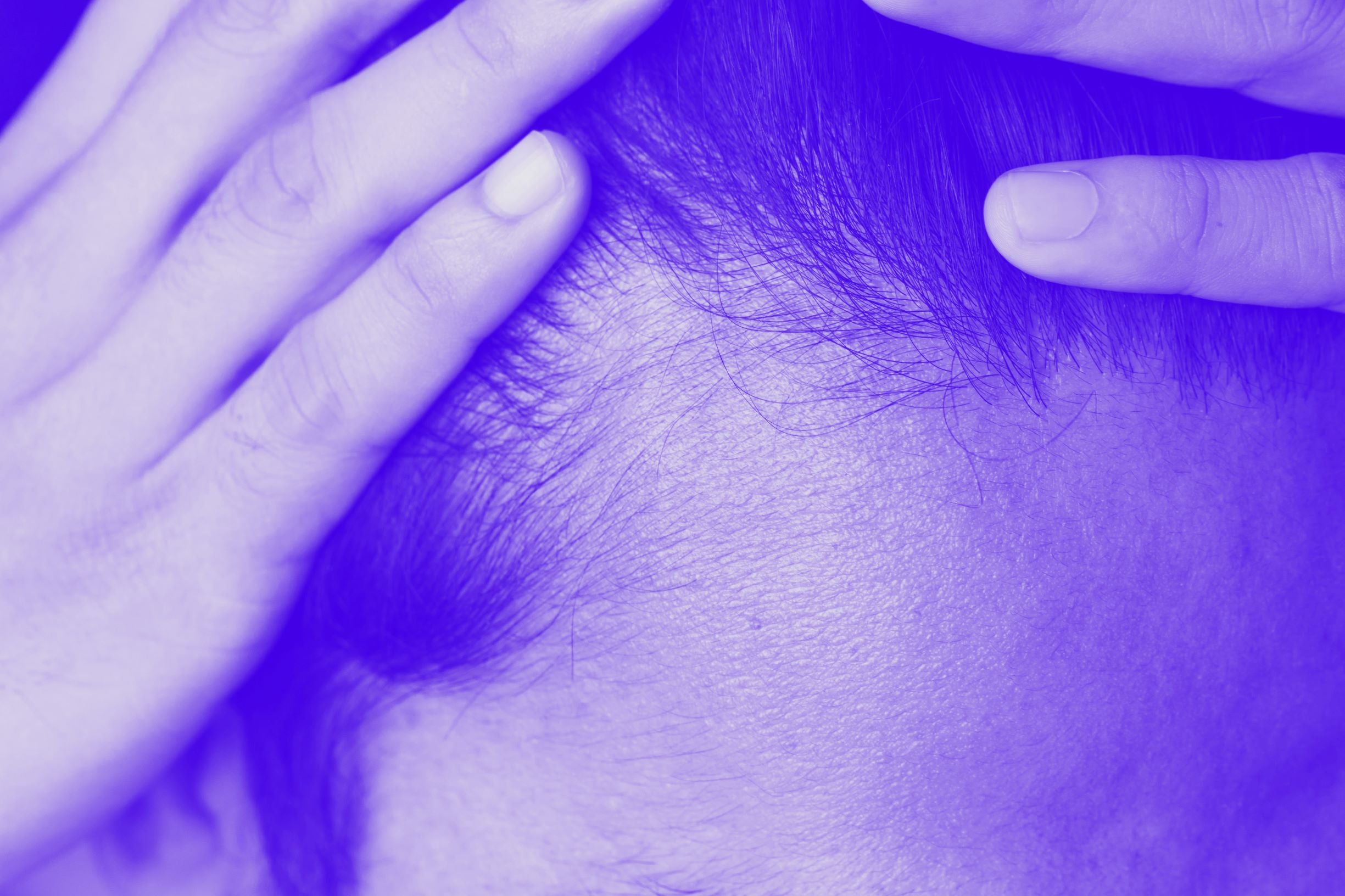 What is diffuse thinning?