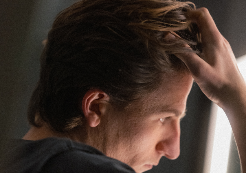 Is Minoxidil Safe for Long Term Use?