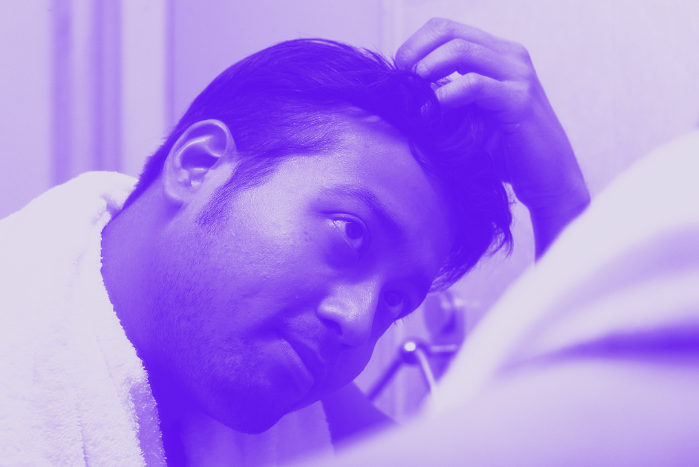 Finasteride vs Minoxidil: The differences and joint benefits for hair loss